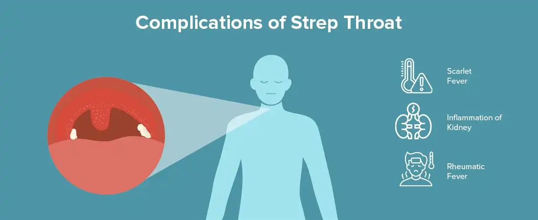 Complications of Strep Throat